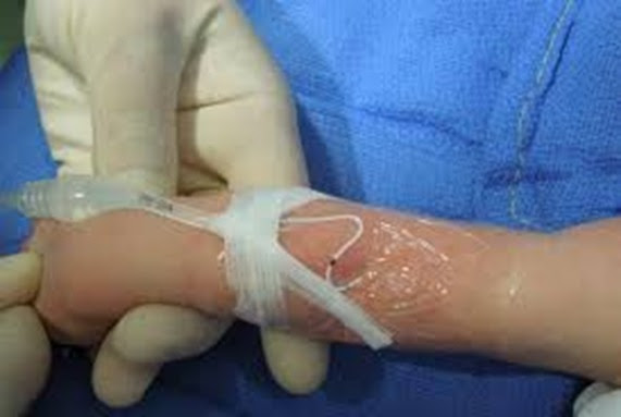 No momento, você está visualizando Amazonas registra 49 incidentes associados aos cuidados em saúde em recém-nascidos entre 2014 e 2022